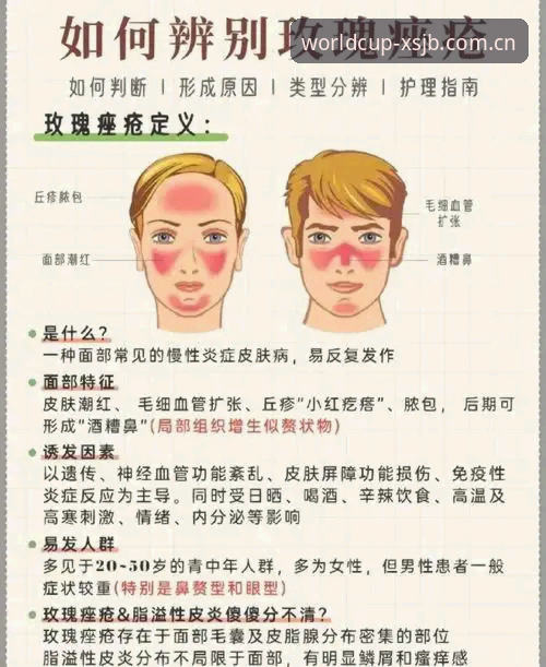 世界杯观赛签证难题完整应对指南：从地缘政治到“XSJB世界杯2025”平台观赛策略